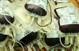 POTREBNA KRV ZA ALMU BRKIĆ (23) U stravičnoj nesreći teško povrijeđena pripadnica Oružanih snaga BiH, kolege mole za pomoć