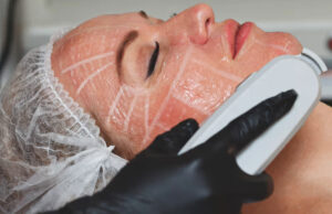 HIFU tretmani kože po akcijskoj cijeni u OM salonu