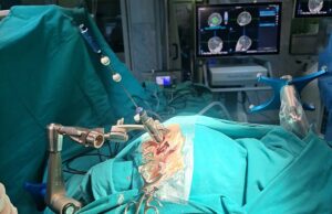 Zenica: Prvi put urađena iglena biopsija mozga