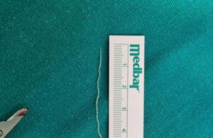 Banjalučki doktor objavio fotografiju: Iz kapka odstranjen crv od 6 cm