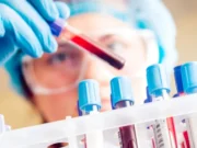 Test krvi otkriva 50 vrsta raka