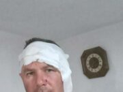 Lovac preživio napad medvjeda: “Moja sreća da je puška bila puna”